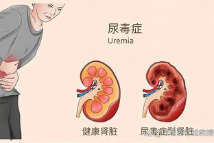 菲奥雷：罗马必须允许迪巴拉在对手禁区前拥有战术自由度